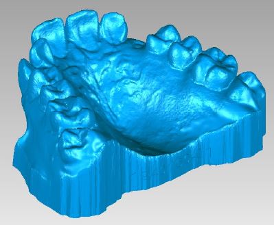 3D Printed Dental