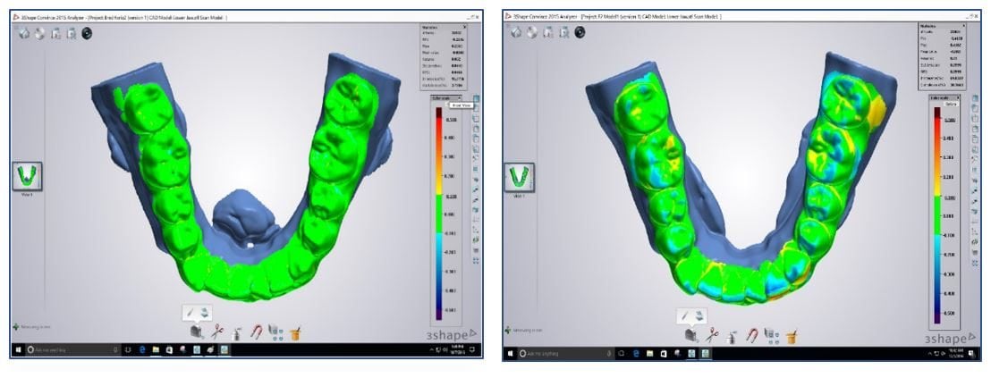 This dental model shown left was 3D printed horizontally on the EnvisionTEC Vida 3D printer and has scan accuracy against the original digital model of 96.3% at 100 µm layer thickness. This dental model at right was printed on a low-priced SLA printer and has scan accuracy against the original model of 69.8%; that means the model is out of tolerance by 30+%.