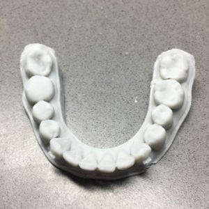 dental-model