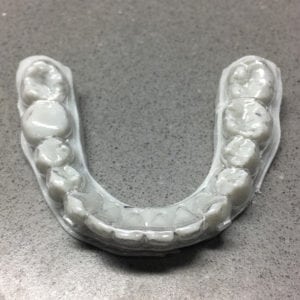 thermoformed-aligner