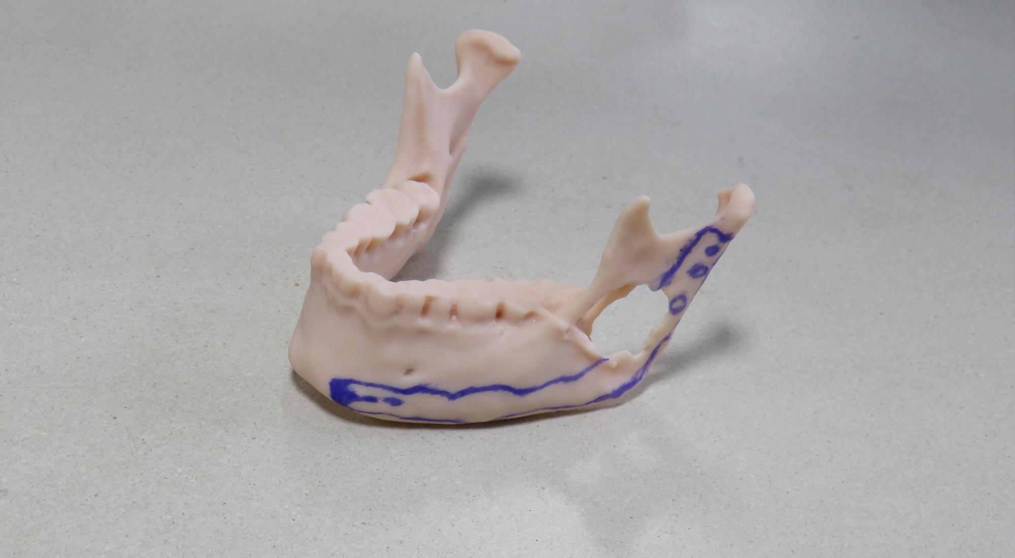 mandible-marked-up