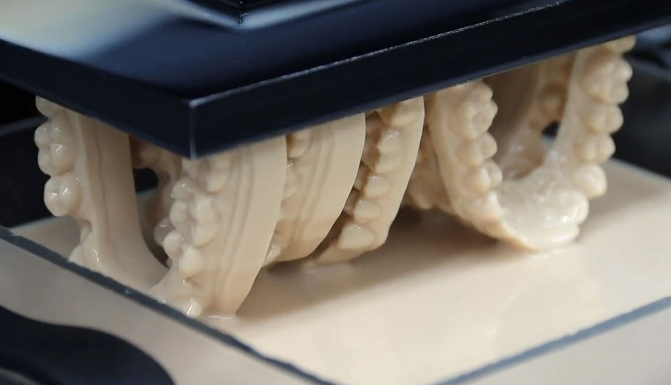 Orthodontic Arches 3D Printed Vertical EnvisionTEC Vida