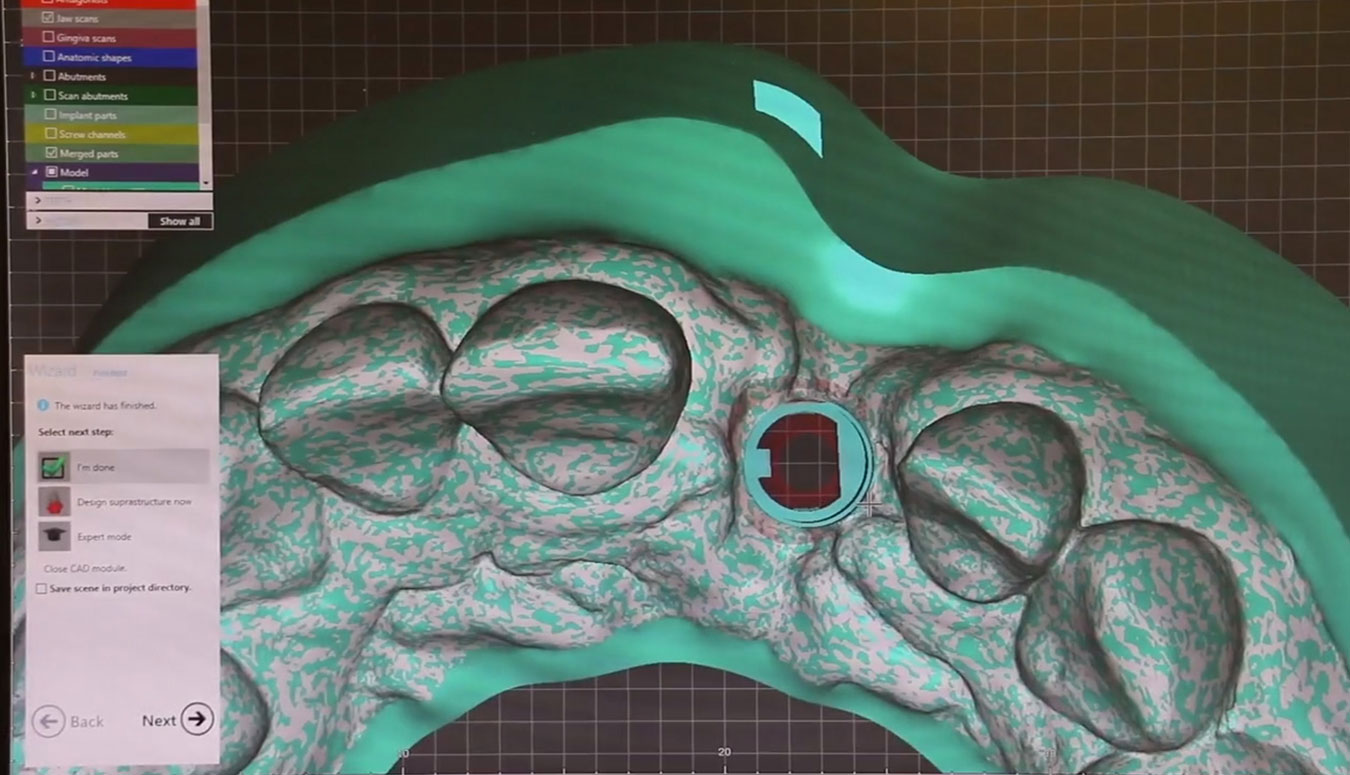 Intra Oral Scan Manipulation - EnvisionTEC