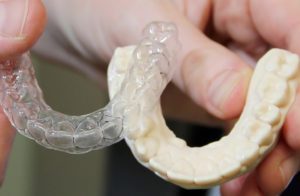 Vacuum Formed Orthodontic Retainers and Model
