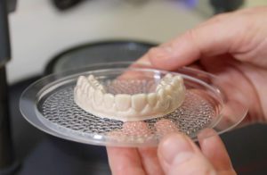 Vacuum Formed Orthodontic Retainers